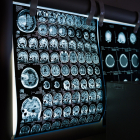 Technologue en imagerie médicale (radiodiagnostic)